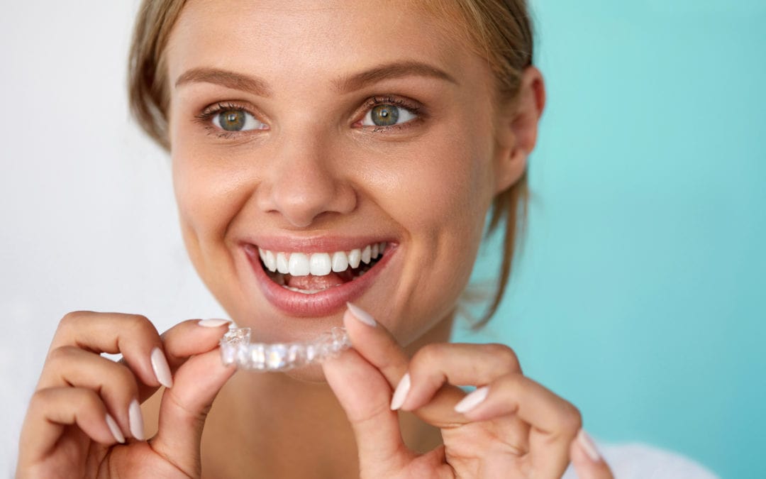 Invisalign SmartForce® Attachments - Overbite and Underbite Correction